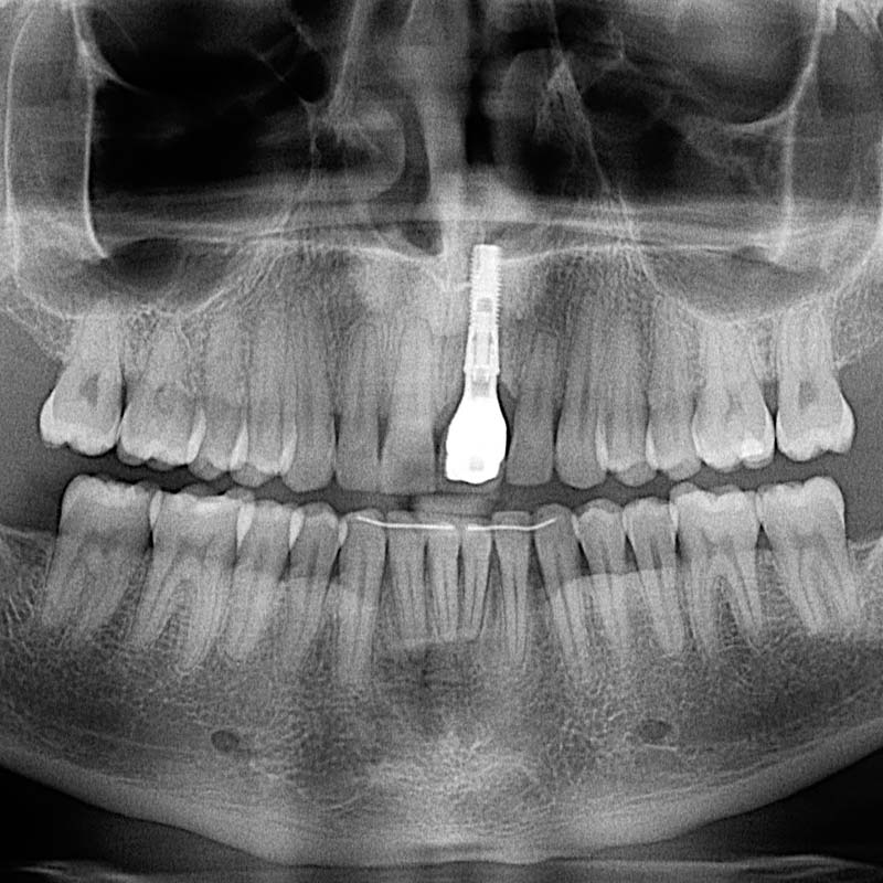Digital Dental Radiographs 